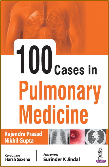100 Cases in Pulmonary Medicine 1st Edition