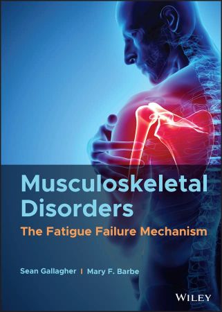 Musculoskeletal Disorders The Fatigue Failure Mechanism (True EPUB)