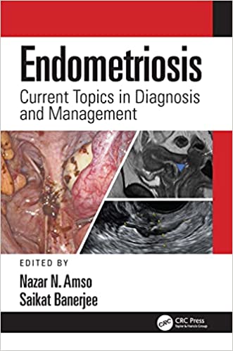Endometriosis Current Topics in Diagnosis and Management