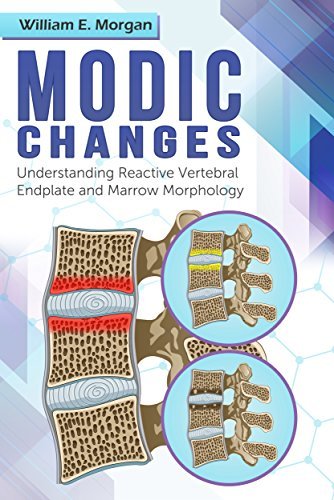 Modic Changes: Understanding Reactive Vertebral Endplate and Marrow Morphology
