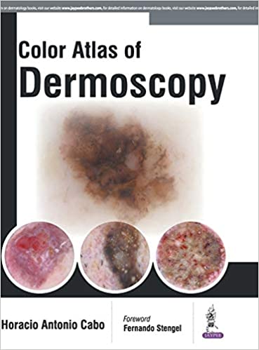 Colour Atlas of Dermoscopy 1st Edition