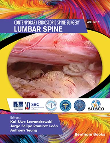 Lumbar Spine: Contemporary Endoscopic Spine Surgery