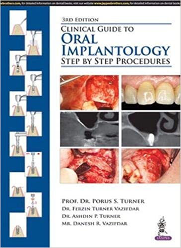 Clinical Guide to Oral Implantology, Step by Step Procedures 3rd Edition