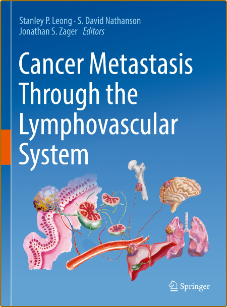 Leong S Cancer Metastasis Through the Lymphovascular System 2022