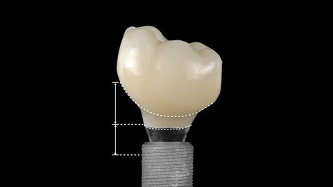 All You Need To Know About Digital Dentistry - Part I