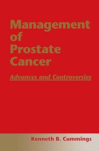 Management of Prostate Cancer Advances and Controversies