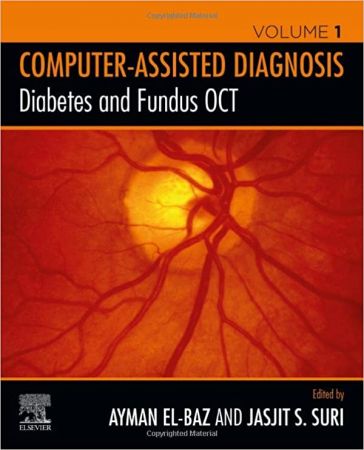 Diabetes and Fundus OCT (Computer Assisted Diagnosis) (Volume 1) 1st Edition