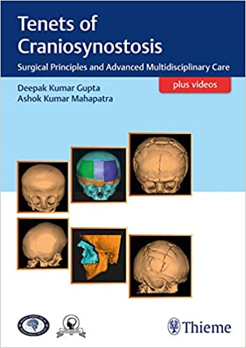 Tenets of Craniosynostosis Surgical Principles and Advanced Multidisciplinary Care 1st Edition