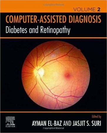 Diabetes and Retinopathy (Computer Assisted Diagnosis) (Volume 2) 1st Edition