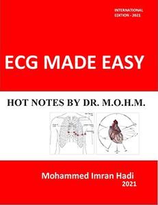 ECG MADE EASY HOT NOTES BY DR. M.O.H.M