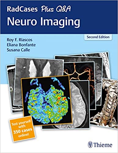 RadCases Plus Q&A Neuro Imaging 2nd Edition
