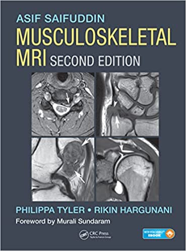 Musculoskeletal MRI 2nd Edition by Asif Saifuddin