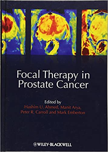 Focal Therapy in Prostate Cancer by Mark Emberton