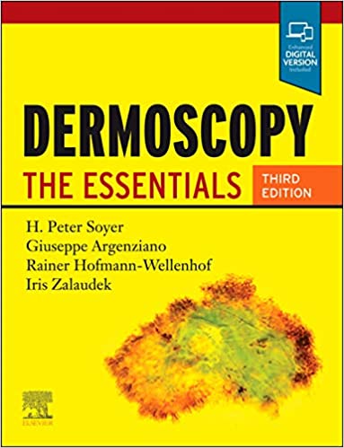Dermoscopy: The Essentials 3rd Edition