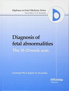 Diagnosis of fetal abnormalities  the 18-23-week scan