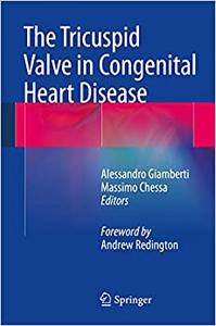 The Tricuspid Valve in Congenital Heart Disease 