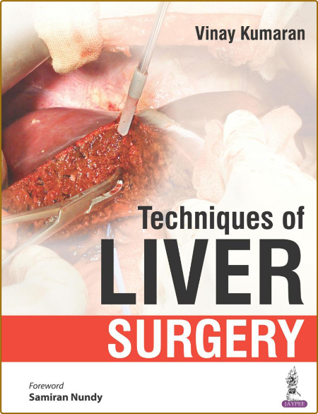  Techniques of Liver Surgery 1st Edition