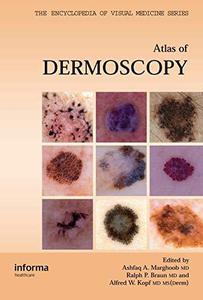Atlas of dermoscopy