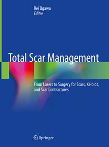 Total Scar Management From Lasers to Surgery for Scars, Keloids, and Scar Contractures 