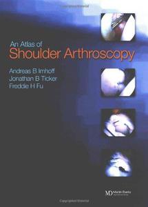 An atlas of shoulder arthroscopy