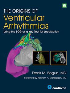The Origins of Ventricular Arrhythmias