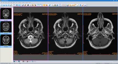 Sante DICOM Viewer Pro 12.1.3