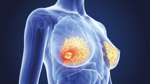 Natural Protocols For Breast Cancer