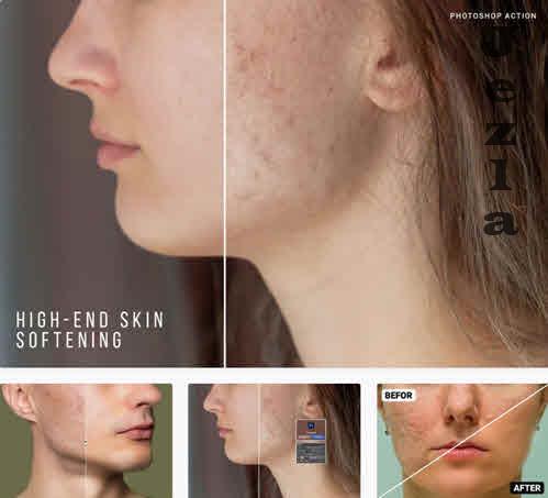 High-End Skin Softening Action