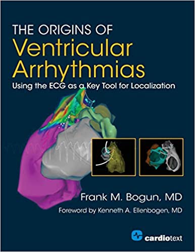 The Origins of Ventricular Arrhythmias Using the ECG as a Key Tool for Localization Volume 1