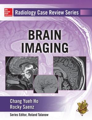 Radiology Case Review Series: Brain Imaging