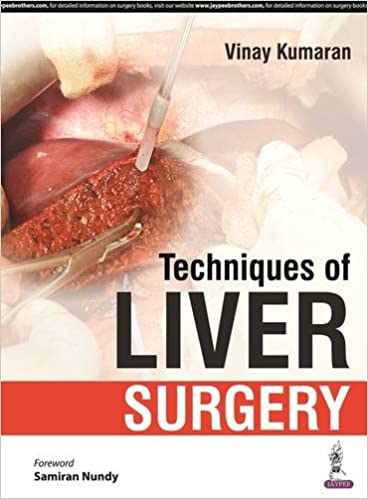 Techniques of Liver Surgery 1st Edition