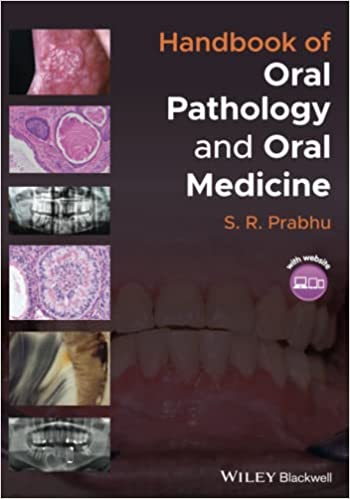 Handbook of Oral Pathology and Oral Medicine 1st Edition