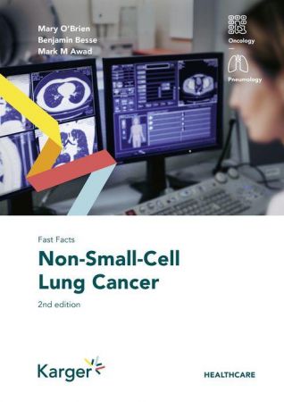 Fast Facts: Non Small Cell Lung Cancer (2022)