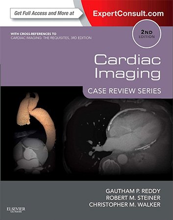 Cardiac Imaging: Case Review, 2nd Edition