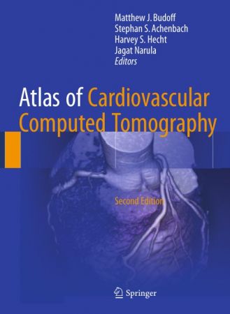 Atlas of Cardiovascular Computed Tomography