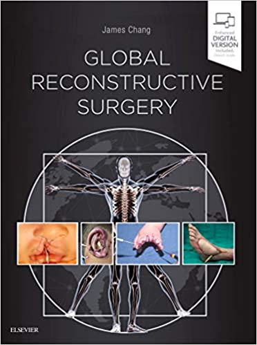 Global Reconstructive Surgery 1st Edition