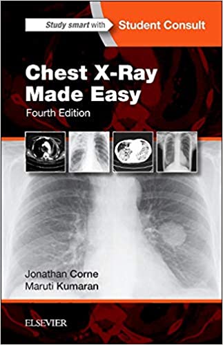 Chest X Ray Made Easy 4th Edition (TRUE PDF & EPUB)
