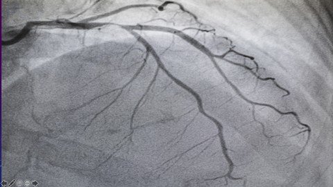 Coronary Angiography Certificate Course