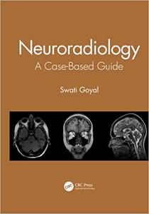 Neuroradiology A Case-Based Guide
