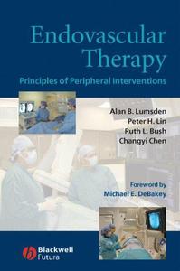 Endovascular Therapy Principles of Peripheral Interventions