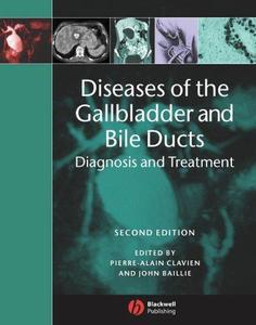 Diseases of the Gallbladder and Bile Ducts Diagnosis and Treatment, Second Edition
