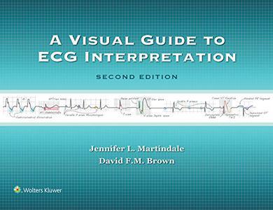 A Visual Guide to ECG Interpretation, 2nd Edition