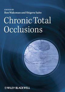 Chronic Total Occlusions A Guide to Recanalization