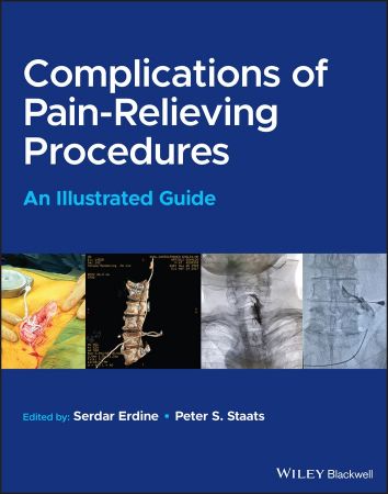 Complications of Pain-Relieving Procedures An Illustrated Guide