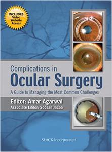 Complications in Ocular Surgery A Guide to Managing the Most Common Challenges