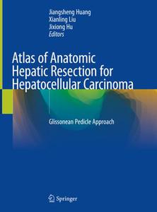 Atlas of Anatomic Hepatic Resection for Hepatocellular Carcinoma Glissonean Pedicle Approach 