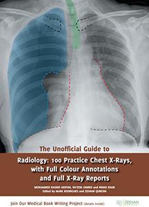 The Unofficial Guide to Radiology 100 Practice Chest X Rays with Full Colour Annotations and Full X Ray Reports 