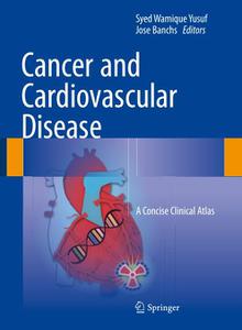 Cancer and Cardiovascular Disease A Concise Clinical Atlas 