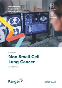 Fast Facts  Non-Small-Cell Lung Cancer, 2nd Edition