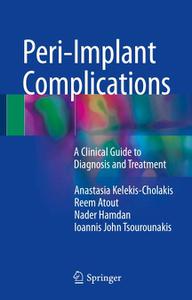Peri-Implant Complications A Clinical Guide to Diagnosis and Treatment